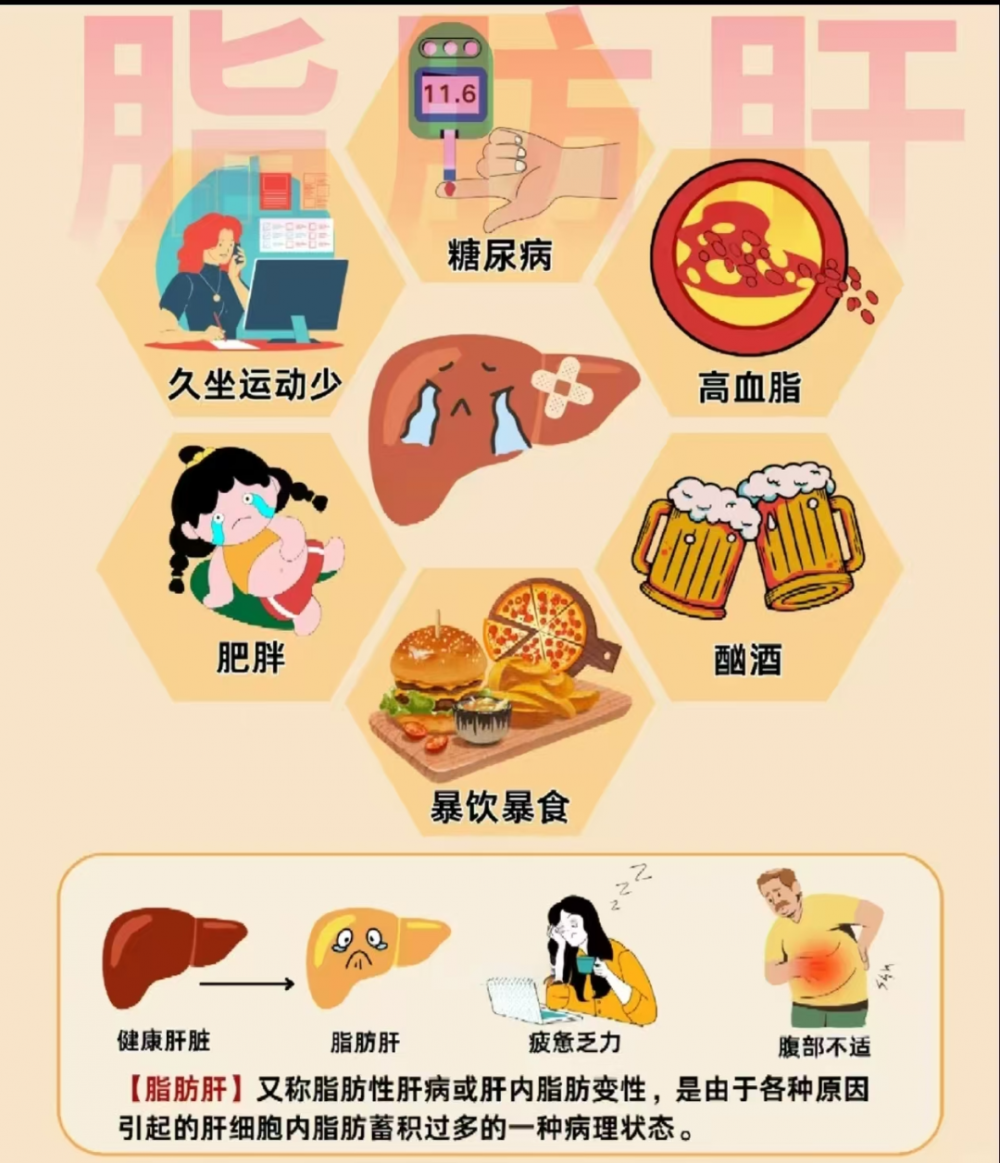 体检查出脂肪肝，真的不用治吗？90%的人都搞错了{bbname}bbs.ahv.cc