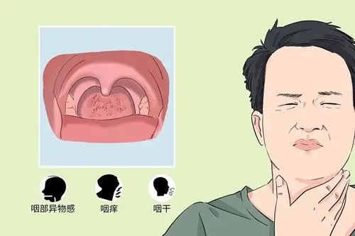 嗓子总有东西咳不出、咽不下？中医调养有方法{bbname}bbs.ahv.cc